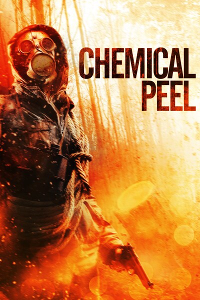 chemical-peel-2014