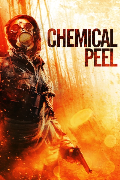 chemical-peel-2014