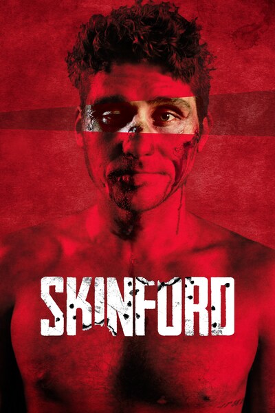 skinford
